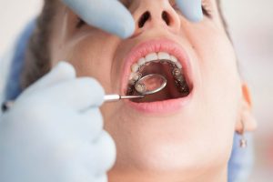 2470658
